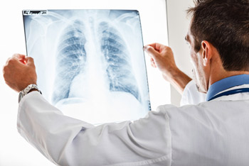 Диагностика рака лёгкого