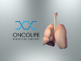 Клінічні дослідження онкології легені