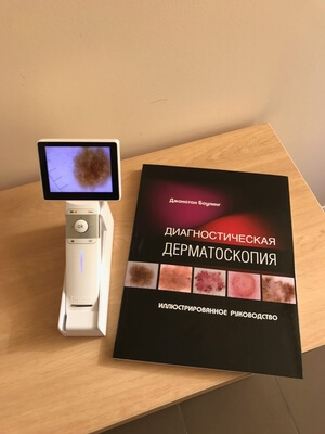 Цифрова дерматоскопія